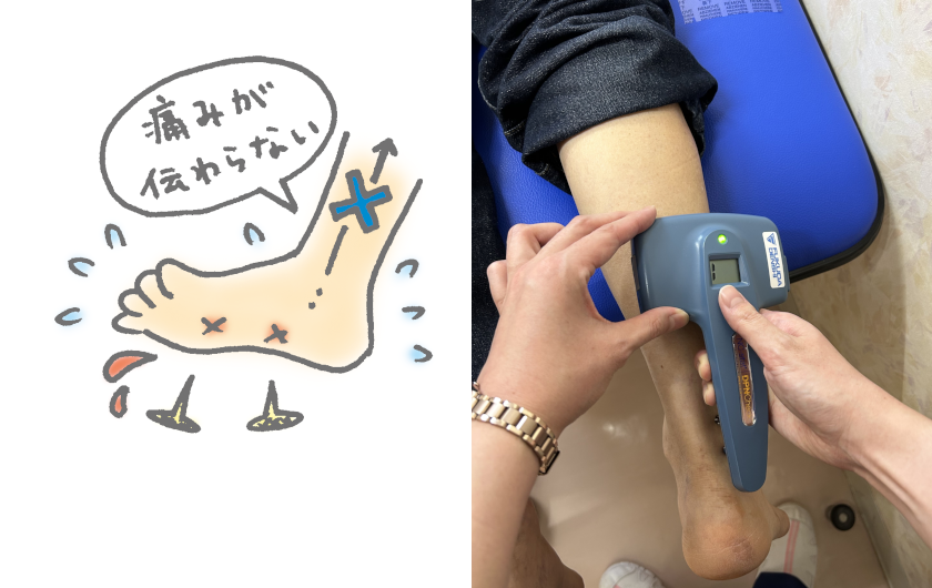 糖尿病の神経伝導検査をはじめました